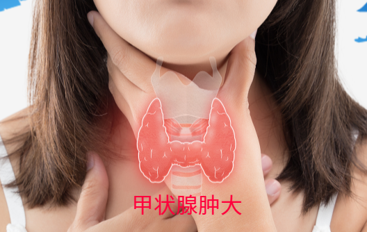 揭开甲亢的神秘面纱:为什么会得这个病? 揭开甲亢的神秘面纱:为什么会得这个病?