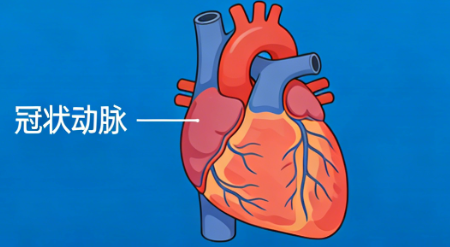 冠心病——心脏的“供血通道”为何会堵? 冠心病——心脏的“供血通道”为何会堵?