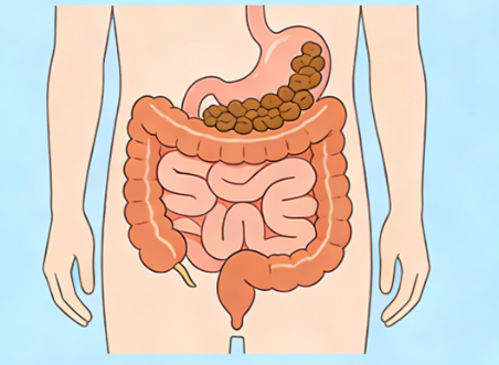 长期便秘有哪些危害? 长期便秘有哪些危害?