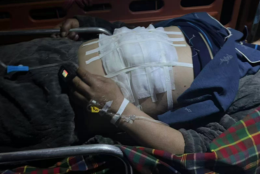 夜间紧急出诊：我院急诊团队妥善处理一例术后切口肠管脱出患者