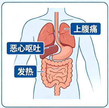急性胰腺炎：不只是“肚子疼”，重症可致命