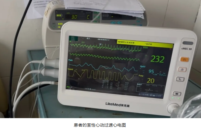 我院心血管内科成功救治一名室速、室颤危重患者