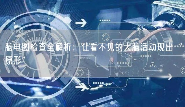 脑电图检查全解析:让看不见的大脑活动现出“原形”
